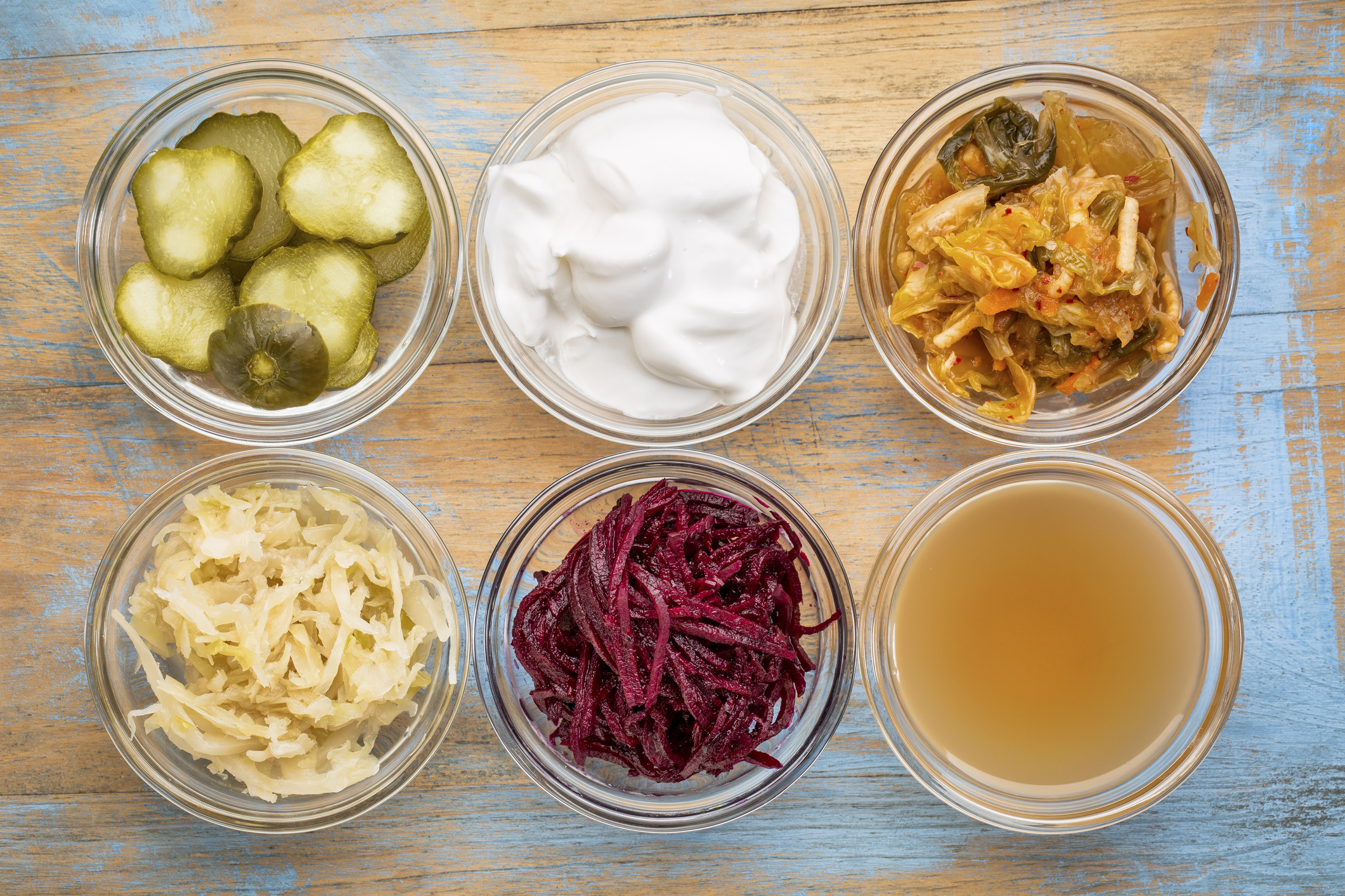 https://media.kombucheria.com/2025/7/3/410597-fermented-foods.jpg